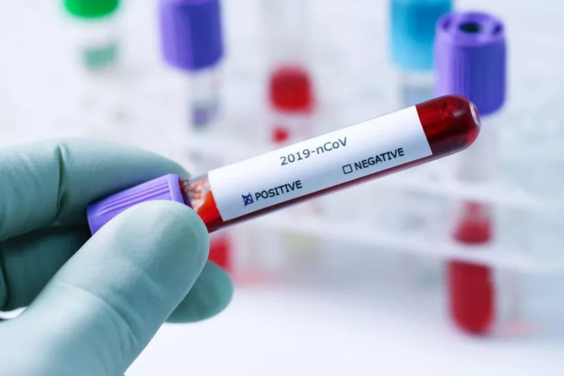 #coronavirus Peste 4.300 de gălățeni izolați la domiciliu, 149 de persoane sunt plasate în carantină