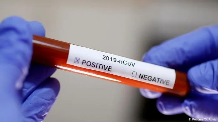 Coronavirus Galați: 31 de persoane decedate și 314 testate pozitiv