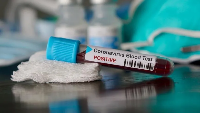 13.163 de infecții, dintre care 790 morți din cauza COVID-19