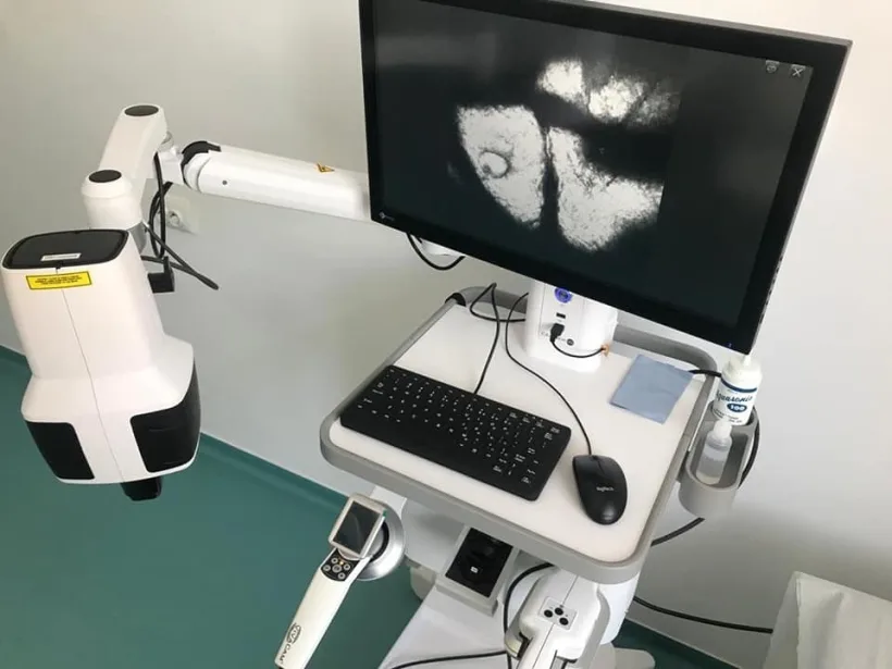 Premieră în România. Spitalul de Boli Infecțioase Galați are echipament medical pentru diagnosticarea cancerului de piele